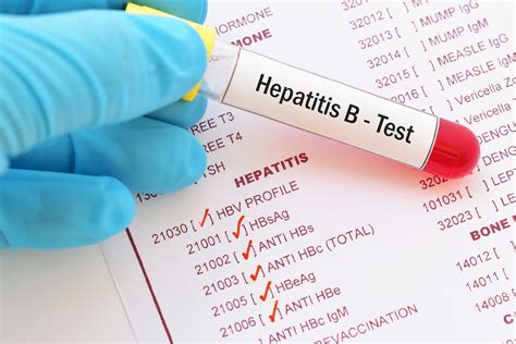 Hepatita B în diabet
